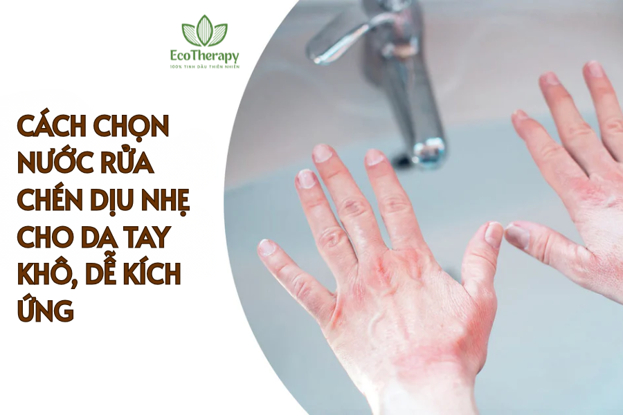 Cách chọn nước rửa chén dịu nhẹ cho da tay khô, dễ kích ứng