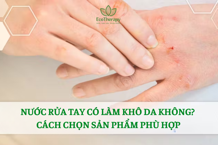 Nước rửa tay có làm khô da không? Cách chọn sản phẩm phù hợp