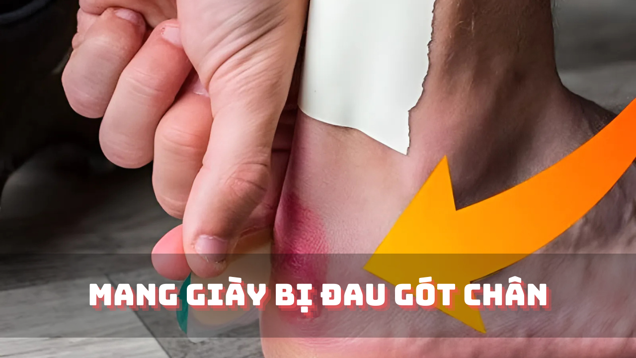 Mang giày bị đau gót chân: Nguyên nhân và cách khắc phục nhanh chóng