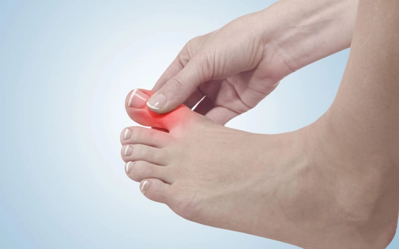15 Cách khắc phục đi giày bị đau ngón chân hiệu quả