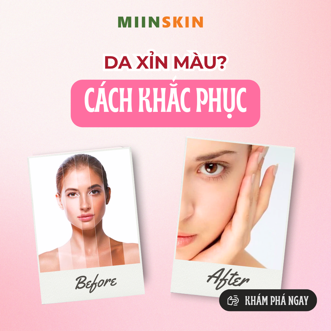 DA XỈN MÀU BUỔI SÁNG? CÁCH KHẮC PHỤC CHO LÀN DA TRẮNG SÁNG