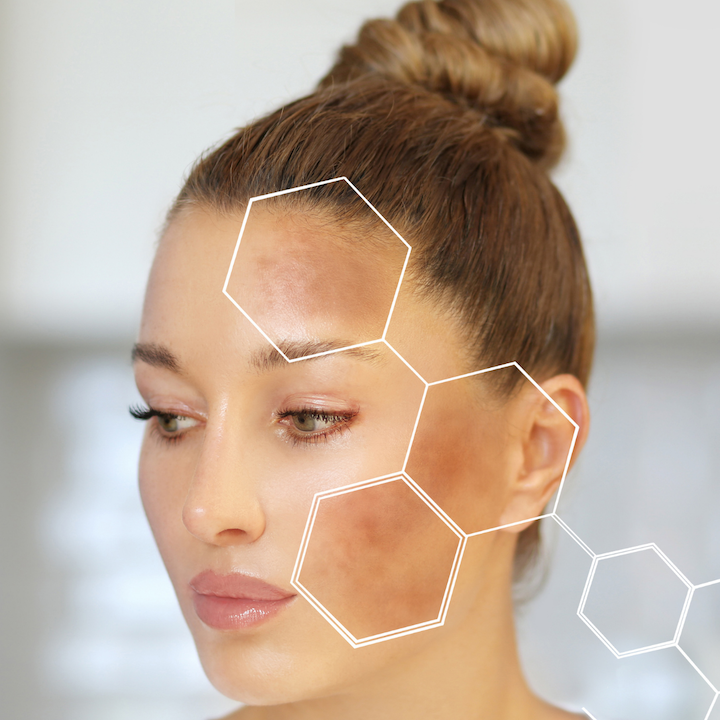 CÔNG DỤNG CỦA PDRN LÀ GÌ? 6 LỢI ÍCH NỔI BẬT VỚI LÀN DA