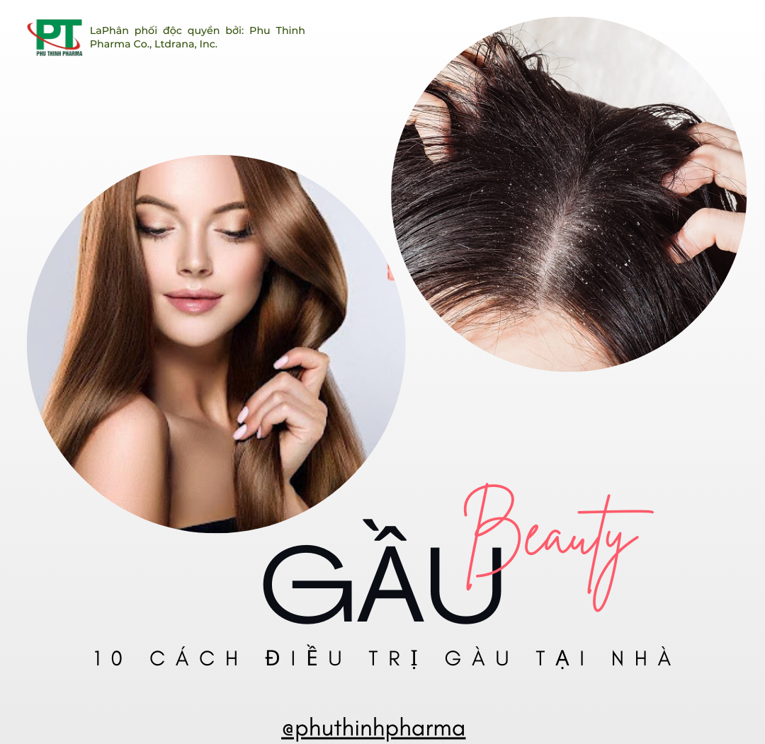Gầu-Nguyên Nhân Da Đầu Bị Gầu Và 10 Cách Điều Trị Tại Nhà