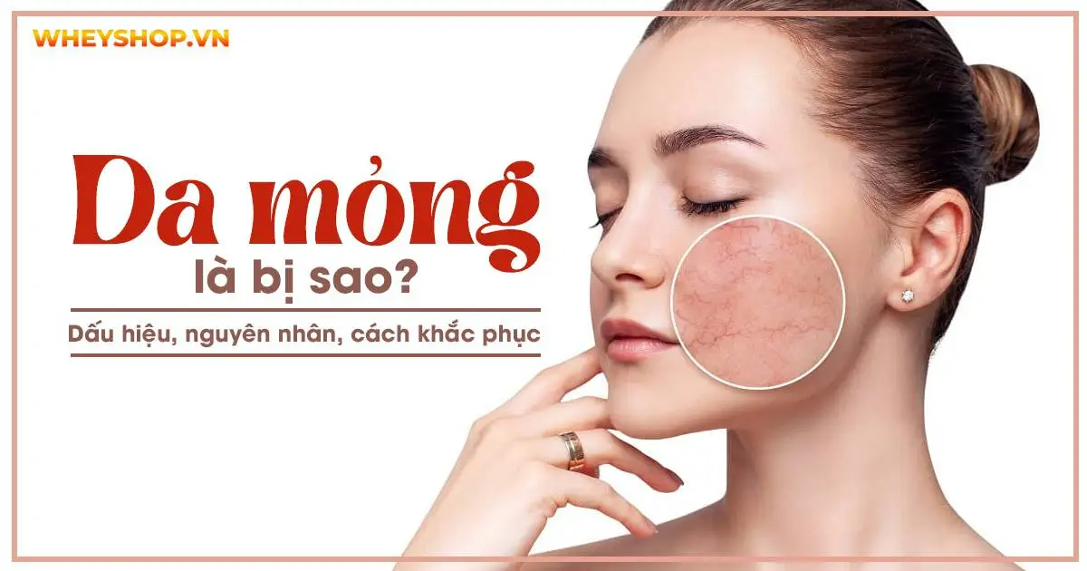 Da mỏng là bị sao? Dấu hiệu, nguyên nhân, cách khắc phục