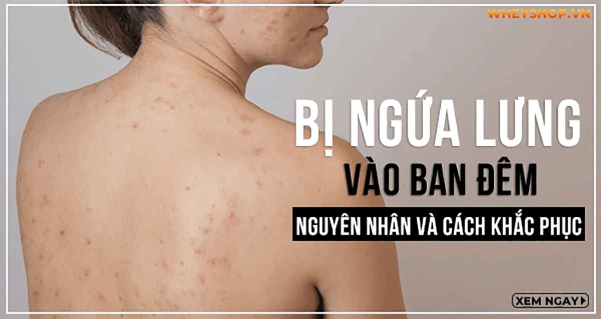 Bị ngứa lưng vào ban đêm: Nguyên nhân và cách khắc phục