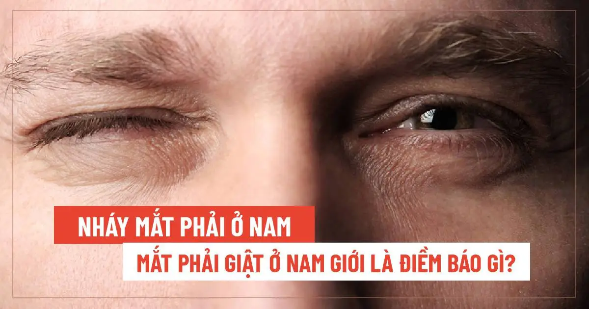 Nháy mắt phải ở nam – Mắt phải giật ở nam giới là điềm báo gì?