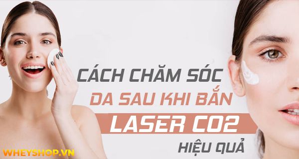 Cách chăm sóc da sau khi bắn laser Co2 hiệu quả và an toàn