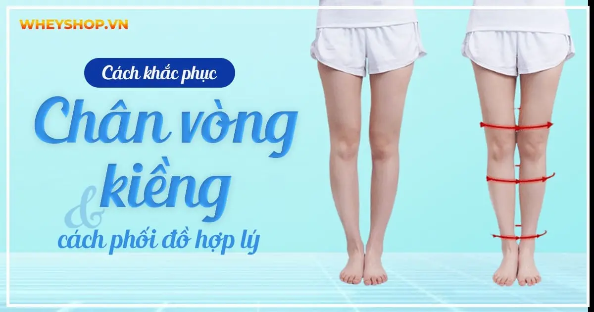 Cách khắc phục chân vòng kiềng và cách phối đồ hợp lý.