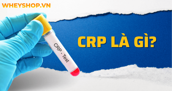 CRP là gì? Tại sao cần tìm hiểu chỉ số xét nghiệm CRP