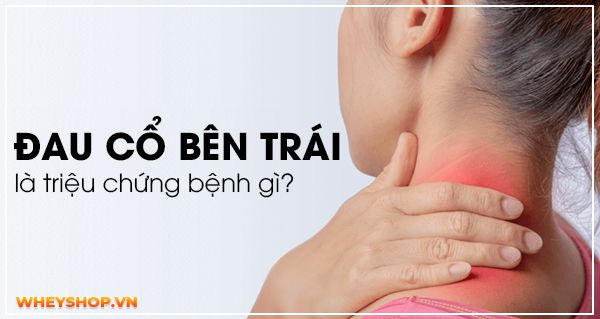 Giải đáp thắc mắc: Đau cổ bên trái là triệu chứng bệnh gì?