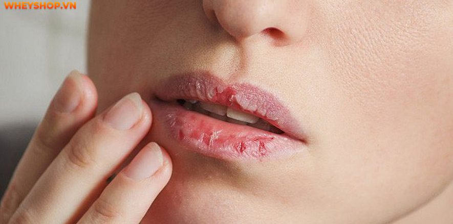 Nếu bạn đang băn khoăn tìm cách tẩy tế bào chết môi thì hãy cùng WheyShop tham khảo chi tiết bài viết tổng hợp 10 cách tẩy tế bào chết môi tại nhà...
