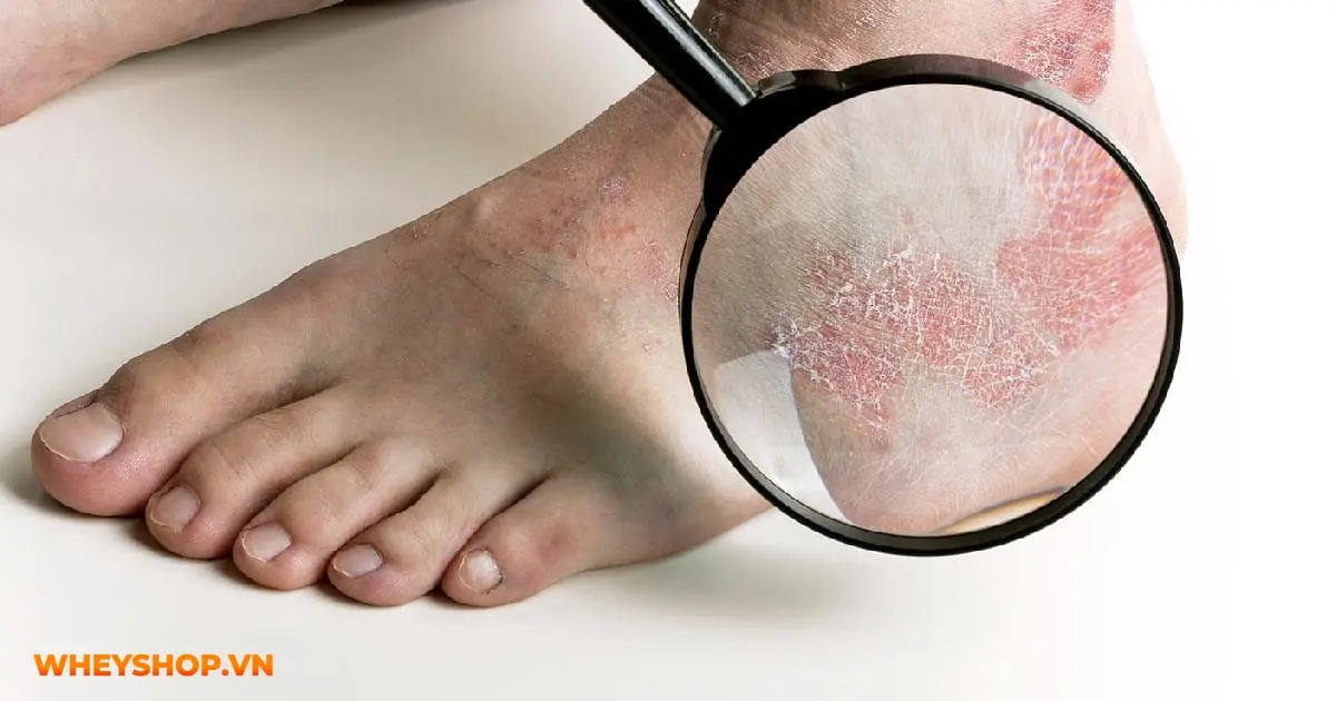 15-loi-ich-cua-dau-dua-05-min