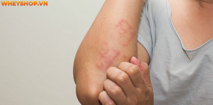 Cảm giác đói bụng liên tục ảnh hưởng đến các hoạt động hàng ngày cũng như hiệu suất trong công việc. Có nhiều yếu tố gây ra tình trạng này, chúng có thể là...