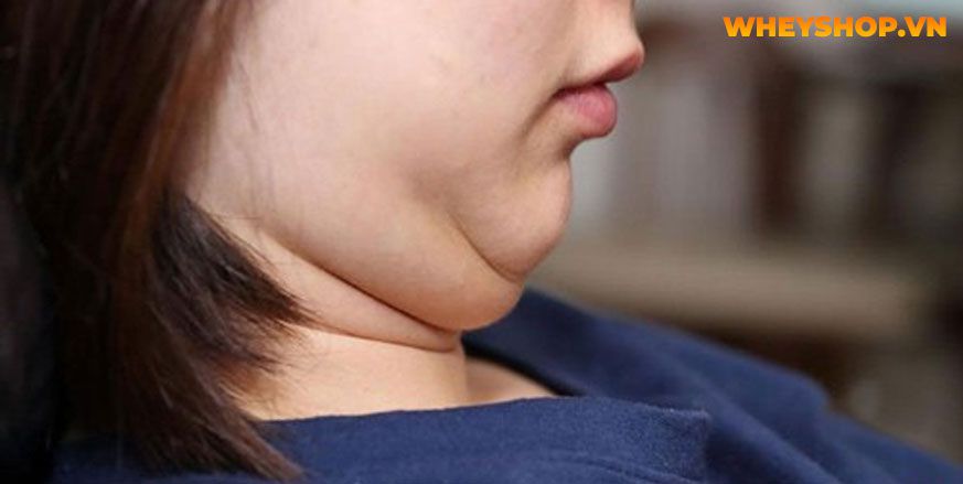 Mặt nọng luôn là nỗi lo của bất kỳ ai, cùng WheyShop tham khảo ngay 10 cách gúp bạn thoát khỏi mặt nọng đơn giản và hiệu quả ngay nhé...