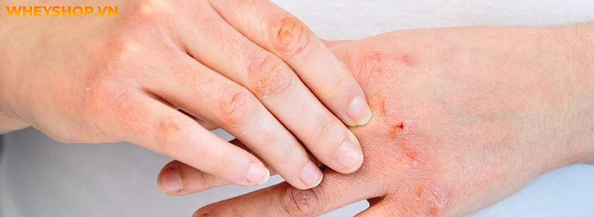 Hạt dẻ là một thực phẩm quen thuộc của chúng ta. Vậy bạn đã hiểu rõ những lợi ích sức khỏe của hạt dẻ mang lại chưa? Cùng WheyShop tham khảo qua bài viết...