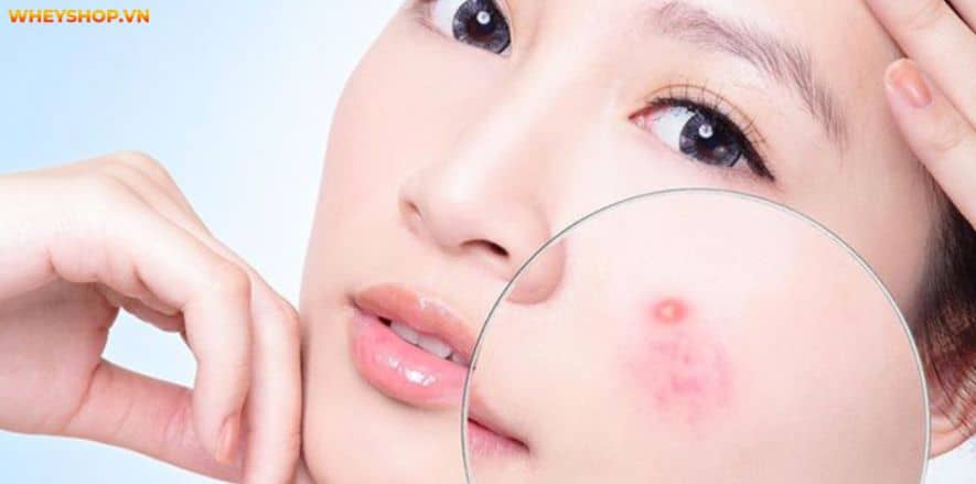 Bánh tráng nướng là món ăn vặt được nhiều người yêu thích bởi hương vị thơm ngon đặc trưng. Vậy bánh tráng nướng bao nhiêu calo không? Cùng WheyShop tìm...