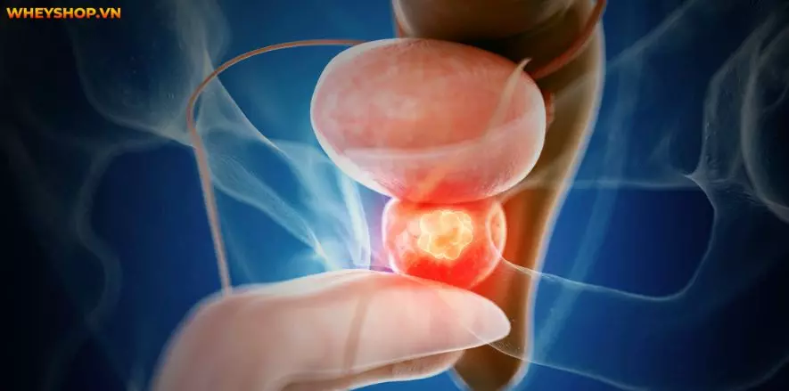 Nhiều ý kiến cho rằng thanh long chứa nhiều đường, nếu đang giảm cân không nên ăn thanh long? Dưới đây là chia s�� của WheyShop về thanh long bao nhiêu calo...