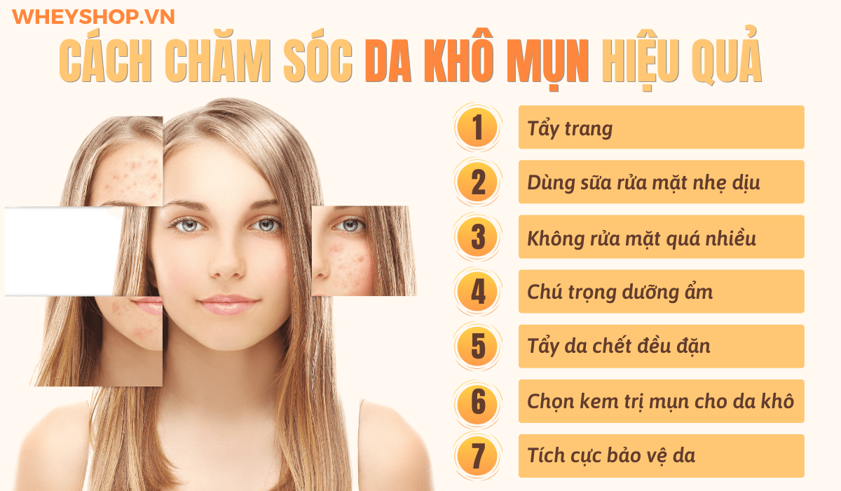 Da khô thường không có mụn và cách chăm sóc da khô thường là chú trọng dưỡng ẩm cho da. Tuy nhiên, vẫn có khá nhiều người sở hữu làn da khô mụn. Nếu không...
