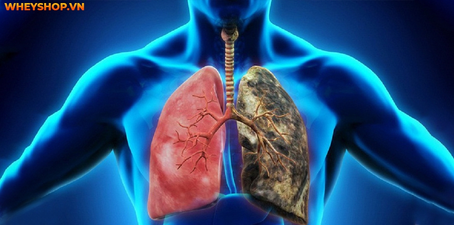 Nếu bạn đang băn khoăn khi bị lao phổi nhưng không ho thì hãy cùng WheyShop tìm hiểu nguyên nhân và giải đáp qua bài viết...