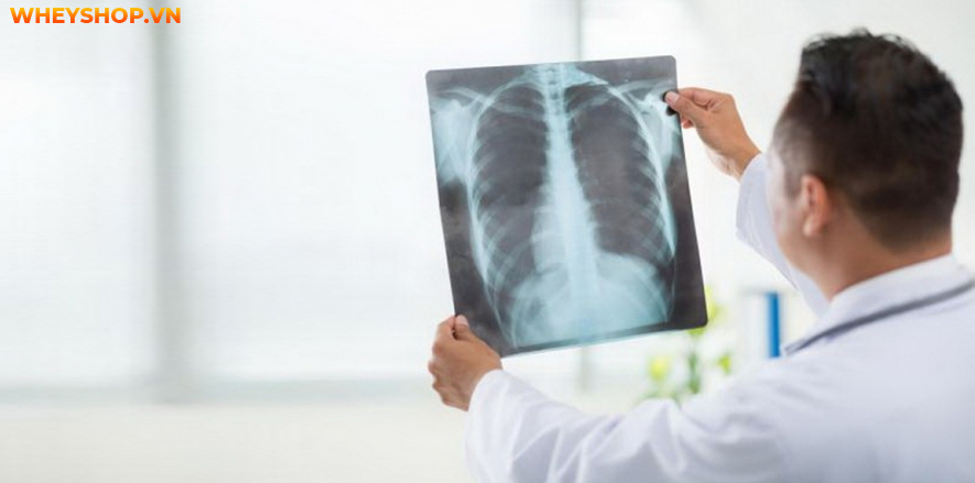 Nếu bạn đang băn khoăn khi bị lao phổi nhưng không ho thì hãy cùng WheyShop tìm hiểu nguyên nhân và giải đáp qua bài viết...