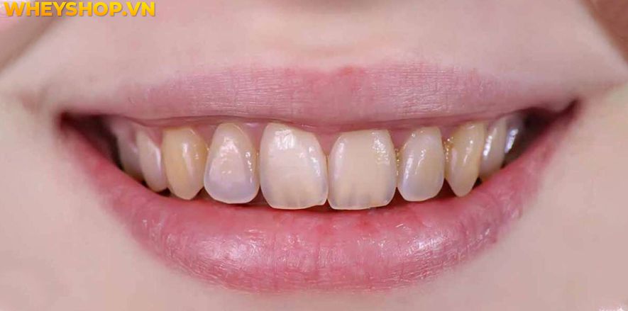 Bạn đã bao giờ nghe đến cách ăn bưởi giảm cân chưa? Và ăn bưởi giảm cân có hiệu quả không? Những thông tin được trình bày trong bài viết này, WheyShop sẽ...