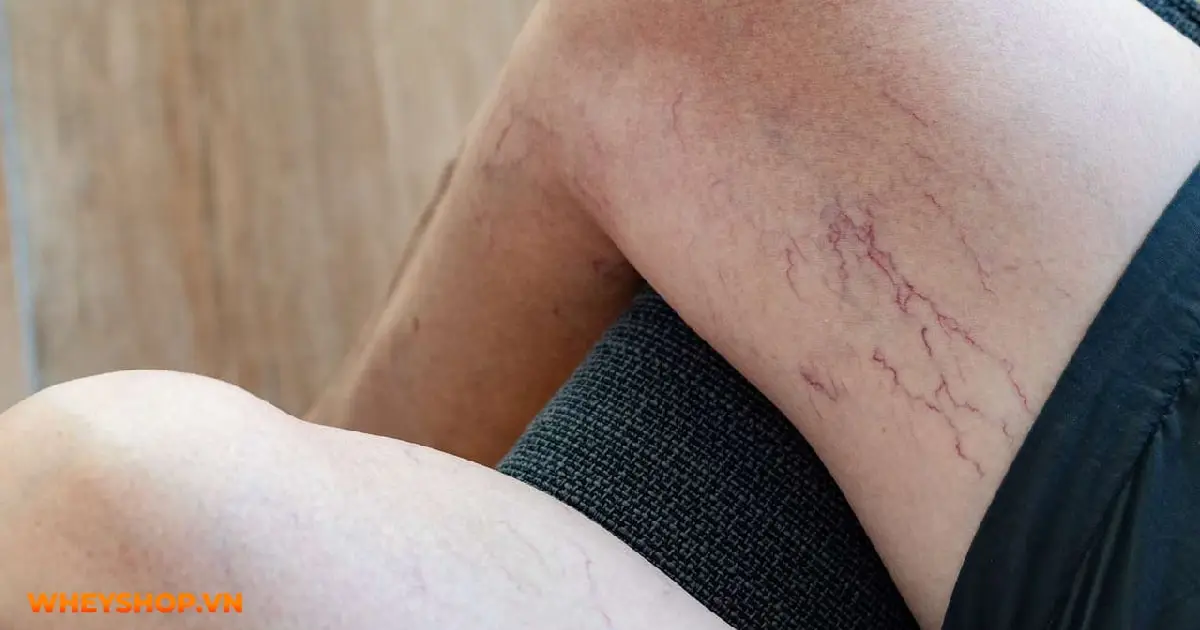 bi-vo-mach-mau-duoi-da-03-min