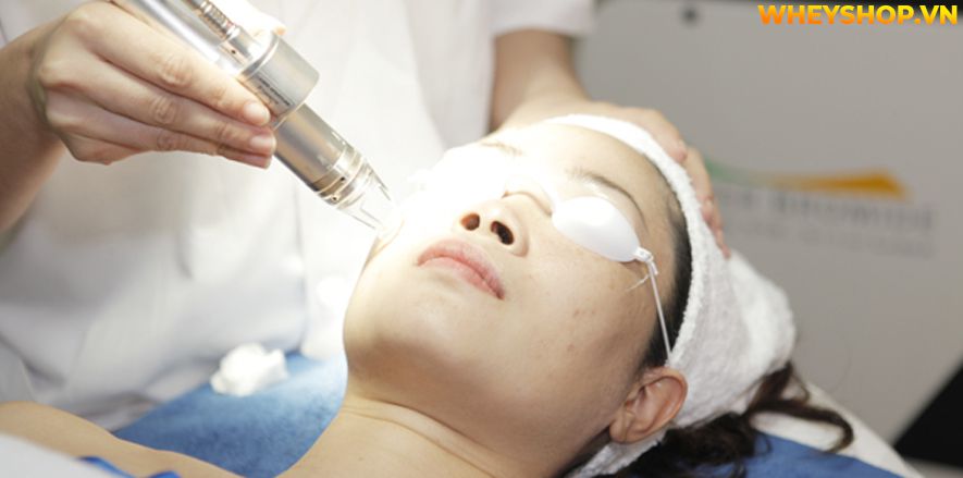 Sau quá trình điều trị, thói quen chăm sóc da sau khi bắn laser co2 hàng ngày đóng vai trò thúc đẩy quá trình chữa lành vết thương, tăng cường sức khỏe làn...