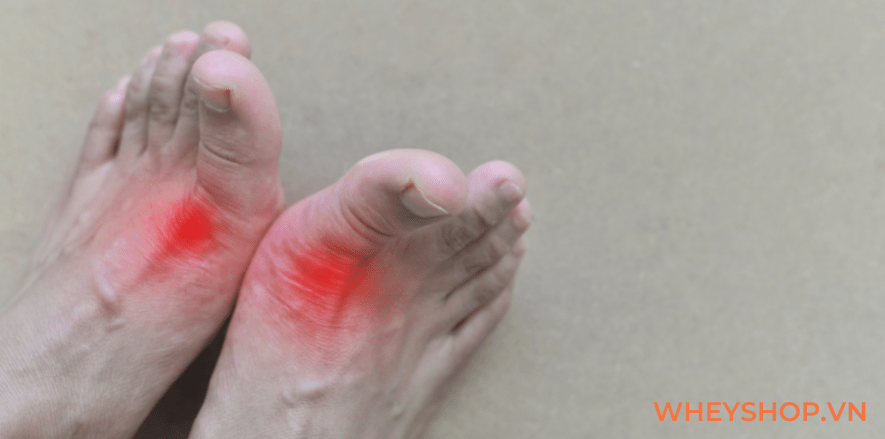 Có nhiều cách chế biến cá sốt cà chua tùy theo vùng miền và loại cá được sử dụng trong chế biến. Bài viết dưới đây WheyShop giúp các bạn học cách chế biến...