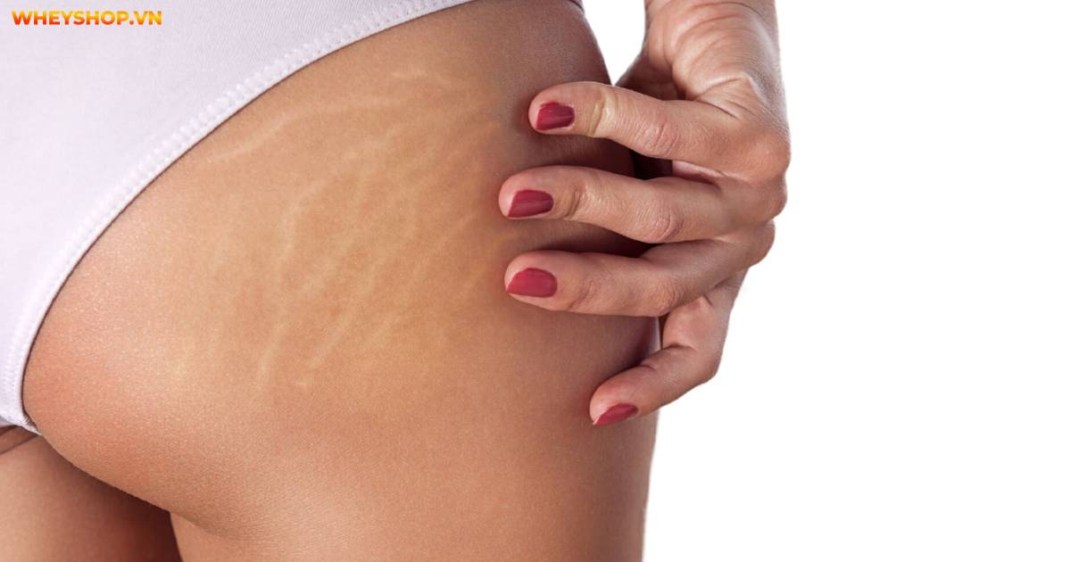 cach-lam-ruou-nghe-boi-mat-sau-sinh