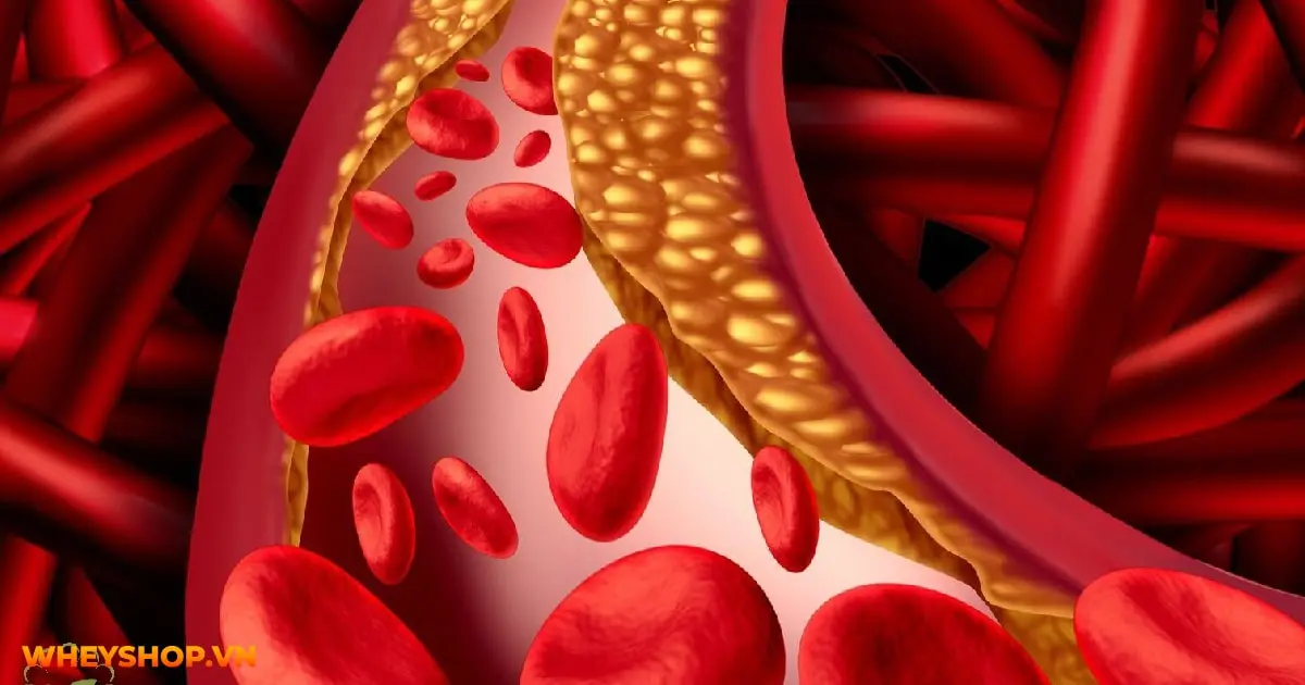 Nếu bạn đang băn khoăn về chỉ số mỡ máu Triglyceride bao nhiêu là nguy hiểm thì hãy cùng WheyShop điểm qua bài viết ngay sau đây...