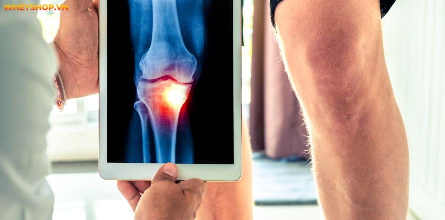 Nếu bạn đang băn khoăn tìm hiểu đánh giá Ostrovit Vitamin D3 4000 K2 có tốt không thì hãy cùng WheyShop tham khảo giải đáp chi tiết qua bài viết...