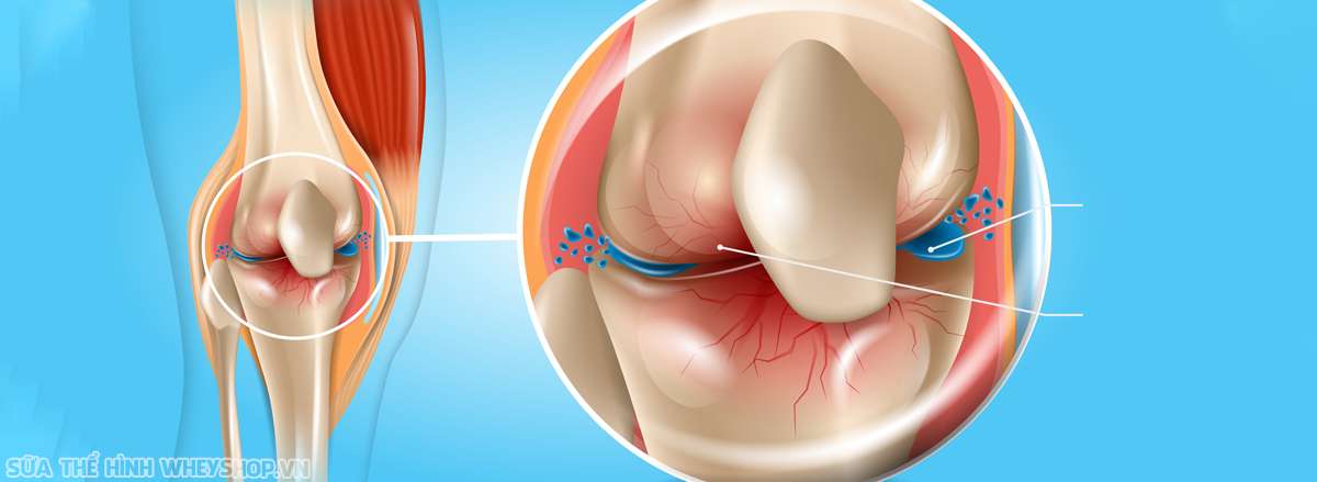 Extreme Joint Care co tot khong sun va khop