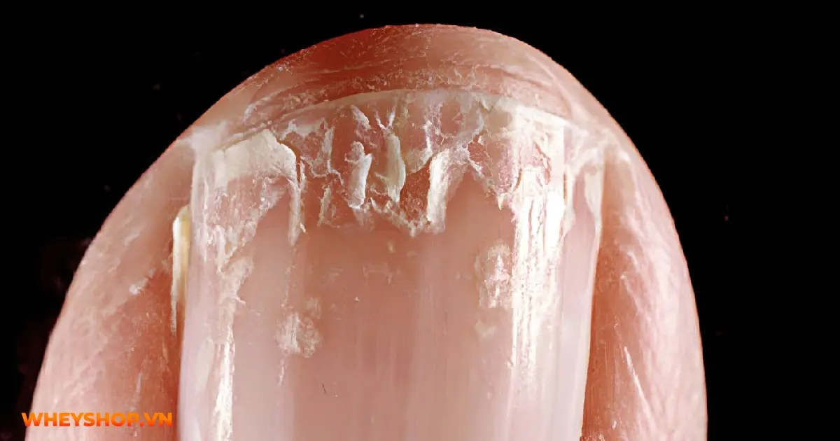 giai-dap-thac-mac-vi-sao-mong-chan-bi-gon-song-03-min