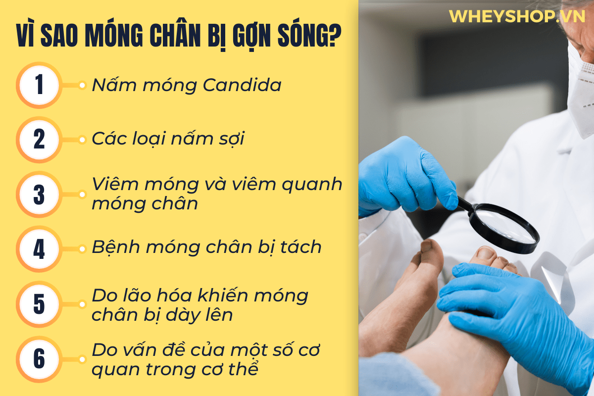 Nếu bạn đang băn khoăn tìm hiểu vì sao móng chân bị gợn sóng thì hãy cùng WheyShop giải đáp chi tiết thắc mắc qua bài viết ngay sau đây nhé...