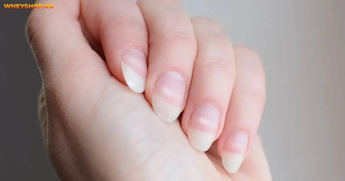 hat-gao-tren-mong-tay-co-phai-la-dau-hieu-benh-4