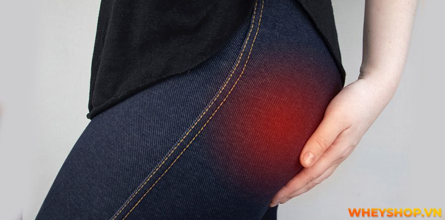 Hiện tượng đau cơ mông từ nhẹ đến nặng ở mông làm giảm sức mạnh của đôi chân và ảnh hưởng đến chất lượng cuộc sống của người bệnh. Nguyên nhân của cơn đau...