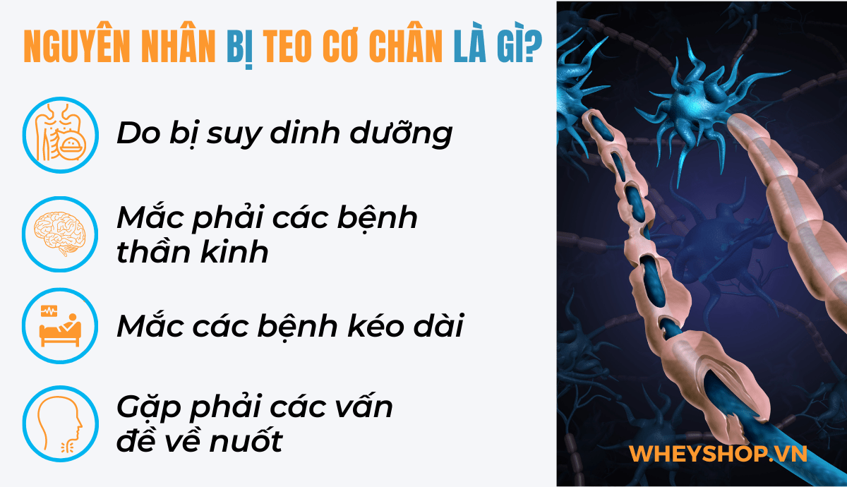 Tình trạng teo cơ có thể được cải thiện bằng cách tuân theo chế độ ăn uống khoa học và thực hiện các bài tập phục hồi teo cơ chân và áp dụng các biện pháp...