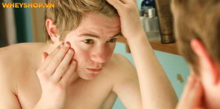 Chăm sóc da không chỉ là của riêng phụ nữ mà việc skincare cho nam cũng vô cùng quan trọng. Bài viết dưới đây WheyShop sẽ giới thiệu các bước skincare cho...