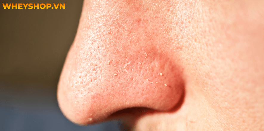 Chăm sóc da không chỉ là của riêng phụ nữ mà việc skincare cho nam cũng vô cùng quan trọng. Bài viết dưới đây WheyShop sẽ giới thiệu các bước skincare cho...