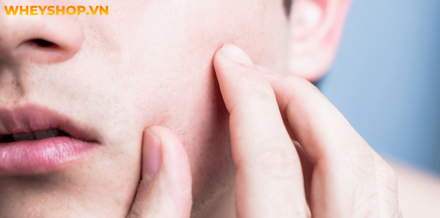 Chăm sóc da không chỉ là của riêng phụ nữ mà việc skincare cho nam cũng vô cùng quan trọng. Bài viết dưới đây WheyShop sẽ giới thiệu các bước skincare cho...