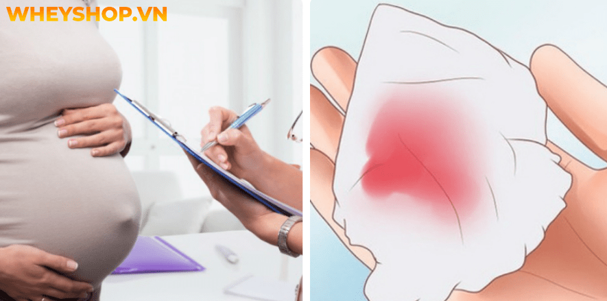 Nếu bạn đang băn khoăn lo lắng việc mang thai 4 tuần bị ra máu có sao không thì hãy cùng WheyShop tham khảo chi tiết bài viết...