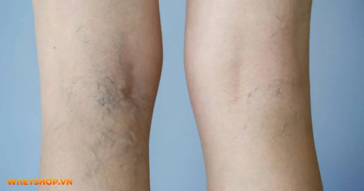 mong-tay-bi-tach-lop-la-dau-hieu-benh-gi-03