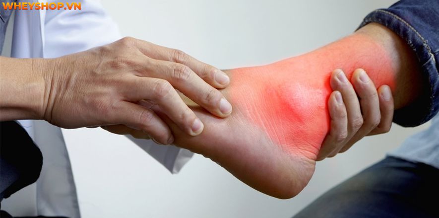 Lá lốt có chứa nhiều tinh dầu có tác dụng kháng viêm hiệu quả. Cách ngâm chân bằng lá lốt từ lâu đã trở nên phổ biến. Tuy nhiên, không phải tất cả mọi đối...