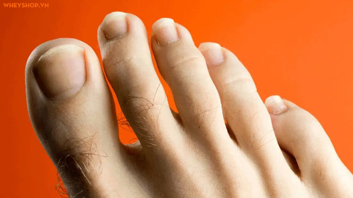 Ngón chân trỏ dài hơn ngón cái nói lên điều gì? | WheyShop