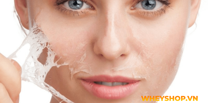Nếu bạn đang băn khoăn việc peel da tại nhà và những lưu ý khi peel da thì hãy cùng WheyShop tham khảo chi tiết bài viết ngay sau đây nhé...