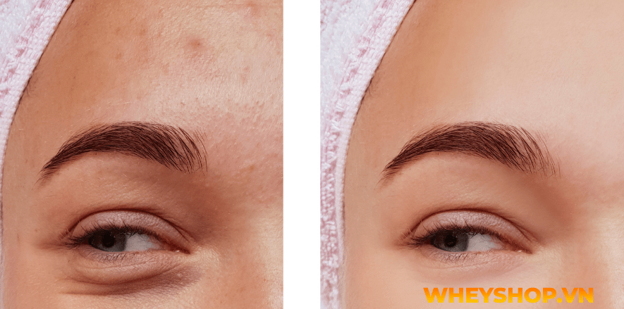 Nếu bạn đang băn khoăn việc peel da tại nhà và những lưu ý khi peel da thì hãy cùng WheyShop tham khảo chi tiết bài viết ngay sau đây nhé...