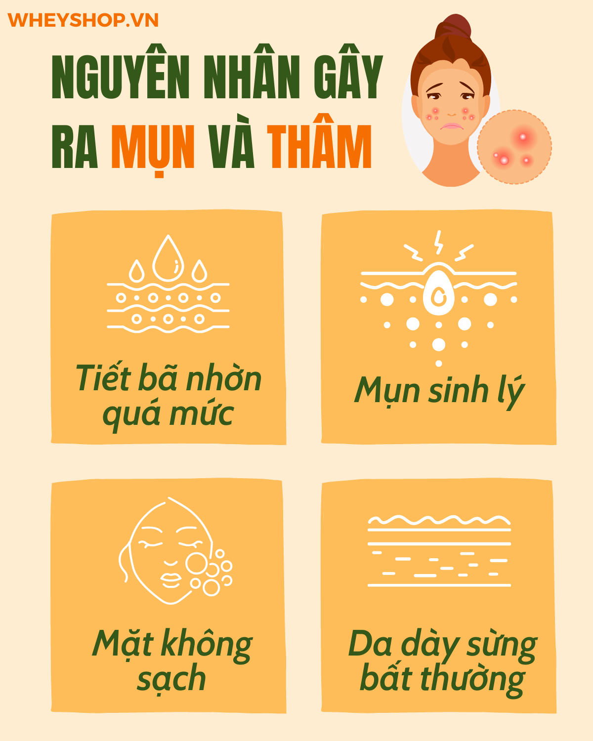 Nếu bạn đang băn khoăn tìm cách chăm sóc da mụn và thâm thì hãy cùng WheyShop tham khảo chi tiết bài viết ngay sau đây...