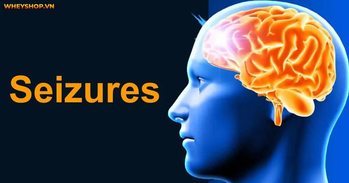 seizure-la-gi-dau-hieu-nhan-biet-cach-dieu-tri-3