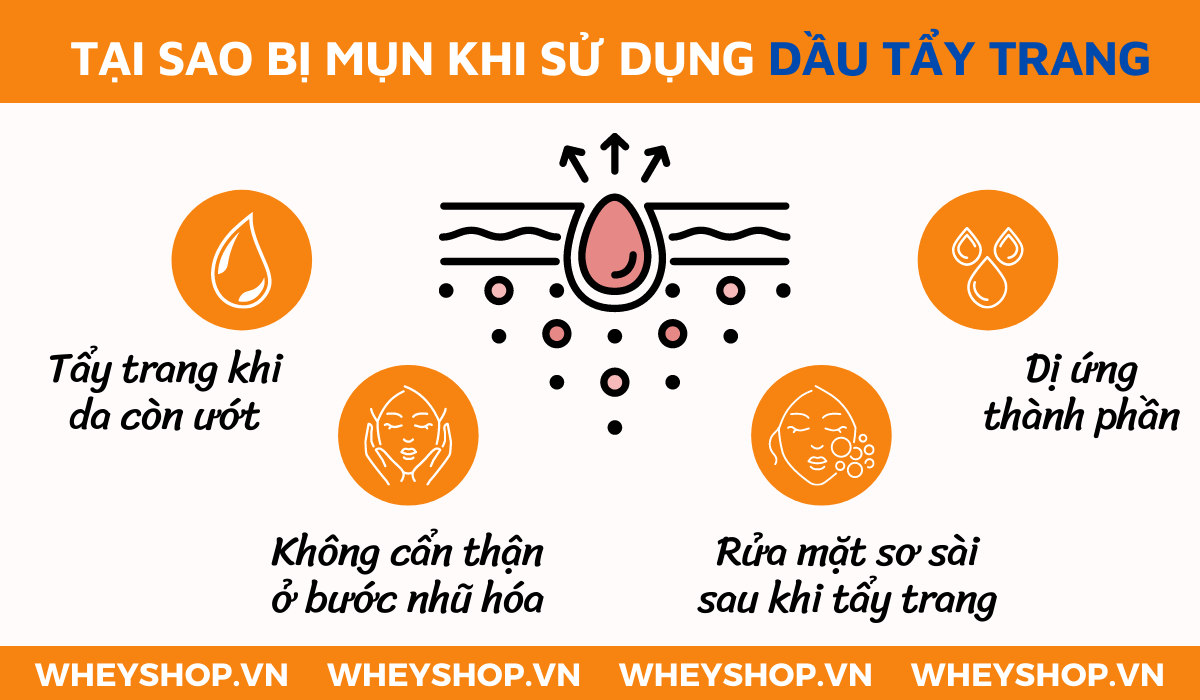 Nếu bạn đang băn khoăn chưa biết lựa chọn loại dầu tẩy trang cho da dầu nào tốt nhất thì hãy cùng WheyShop tham khảo chi tiết...