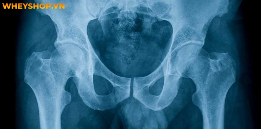 Đạp xe là một trong những môn thể thao được nhiều người tập luyện để rèn luyện sức khỏe. Tuy nhiên, đạp xe nhiều có tốt không? Tác hại của việc đi xe đạp cần...